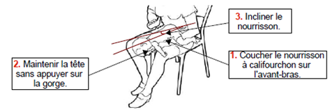 diagrama de palmadas en la espalda para despejar las vías respiratorias del bebé